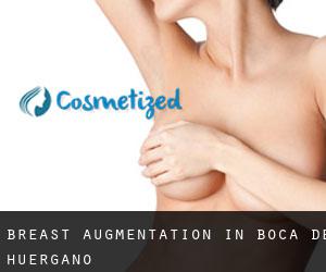 Breast Augmentation in Boca de Huérgano