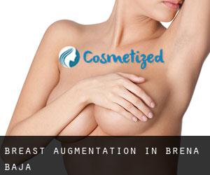 Breast Augmentation in Breña Baja