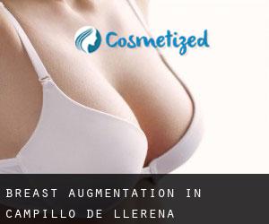 Breast Augmentation in Campillo de Llerena