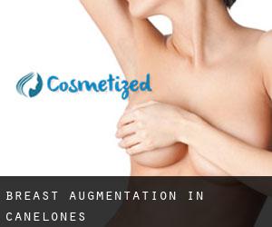 Breast Augmentation in Canelones