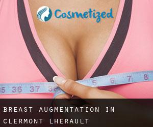 Breast Augmentation in Clermont-l'Hérault