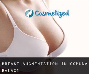 Breast Augmentation in Comuna Balaci