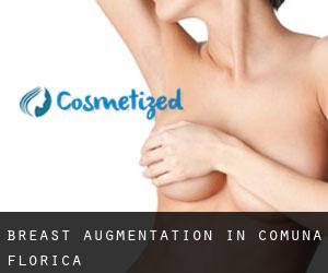 Breast Augmentation in Comuna Florica