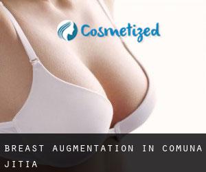 Breast Augmentation in Comuna Jitia