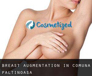 Breast Augmentation in Comuna Păltinoasa