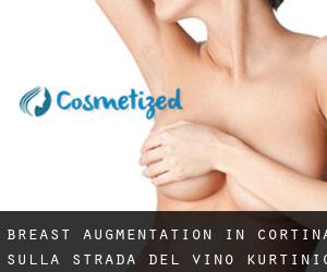 Breast Augmentation in Cortina sulla strada del vino - Kurtinig an der Weinstrasse