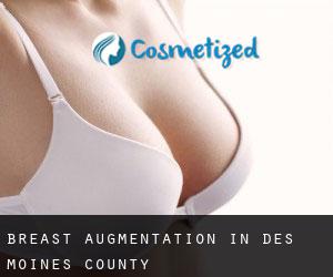 Breast Augmentation in Des Moines County