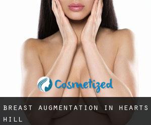 Breast Augmentation in Heart's Hill