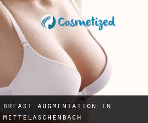 Breast Augmentation in Mittelaschenbach