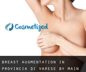 Breast Augmentation in Provincia di Varese by main city - page 1