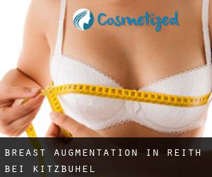 Breast Augmentation in Reith bei Kitzbühel