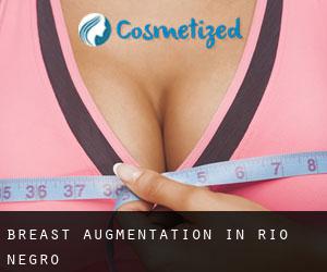 Breast Augmentation in Rio Negro