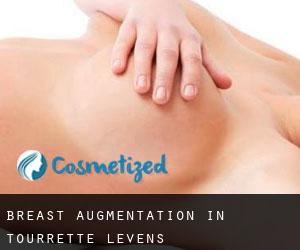 Breast Augmentation in Tourrette-Levens