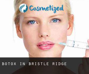 Botox in Bristle Ridge