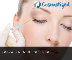 Botox in Can Partera