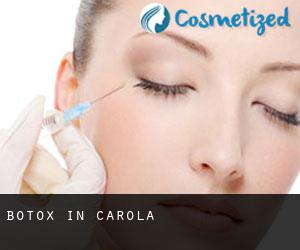 Botox in Carola