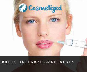Botox in Carpignano Sesia