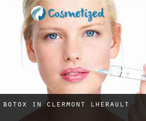 Botox in Clermont-l'Hérault