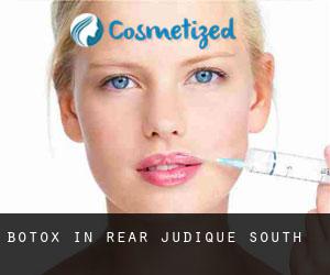 Botox in Rear Judique South