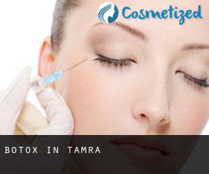 Botox in Tamra