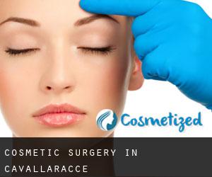 Cosmetic Surgery in Cavallaracce