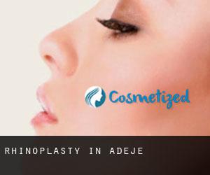 Rhinoplasty in Adeje