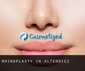 Rhinoplasty in Altendiez