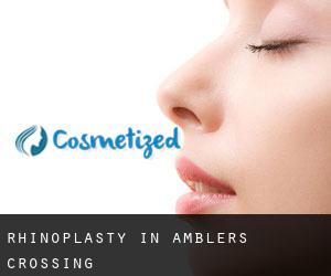 Rhinoplasty in Amblers Crossing