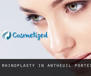 Rhinoplasty in Antheuil-Portes