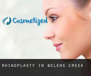 Rhinoplasty in Belews Creek