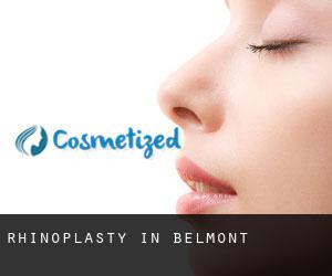 Rhinoplasty in Belmont