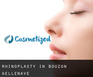 Rhinoplasty in Bouzon-Gellenave