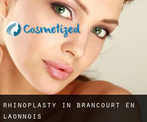 Rhinoplasty in Brancourt-en-Laonnois