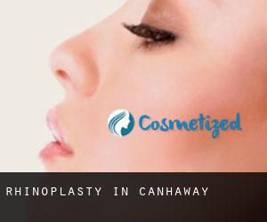 Rhinoplasty in Canhaway