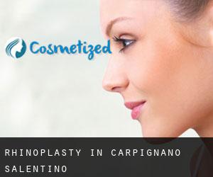 Rhinoplasty in Carpignano Salentino