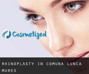 Rhinoplasty in Comuna Lunca (Mureş)