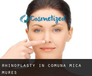 Rhinoplasty in Comuna Mica (Mureş)