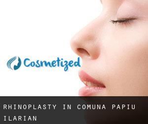 Rhinoplasty in Comuna Papiu Ilarian