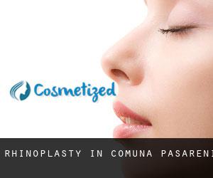 Rhinoplasty in Comuna Păsăreni