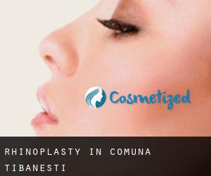 Rhinoplasty in Comuna Ţibăneşti