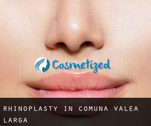 Rhinoplasty in Comuna Valea Largă