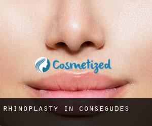 Rhinoplasty in Conségudes