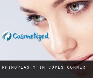 Rhinoplasty in Copes Corner