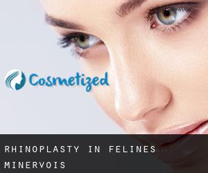 Rhinoplasty in Félines-Minervois