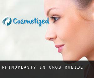 Rhinoplasty in Groß Rheide