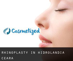 Rhinoplasty in Hidrolândia (Ceará)