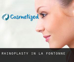 Rhinoplasty in La Fontonne