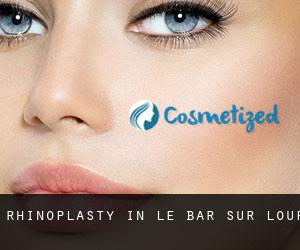 Rhinoplasty in Le Bar-sur-Loup