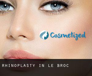 Rhinoplasty in Le Broc