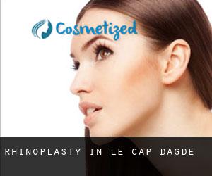 Rhinoplasty in Le Cap D'Agde